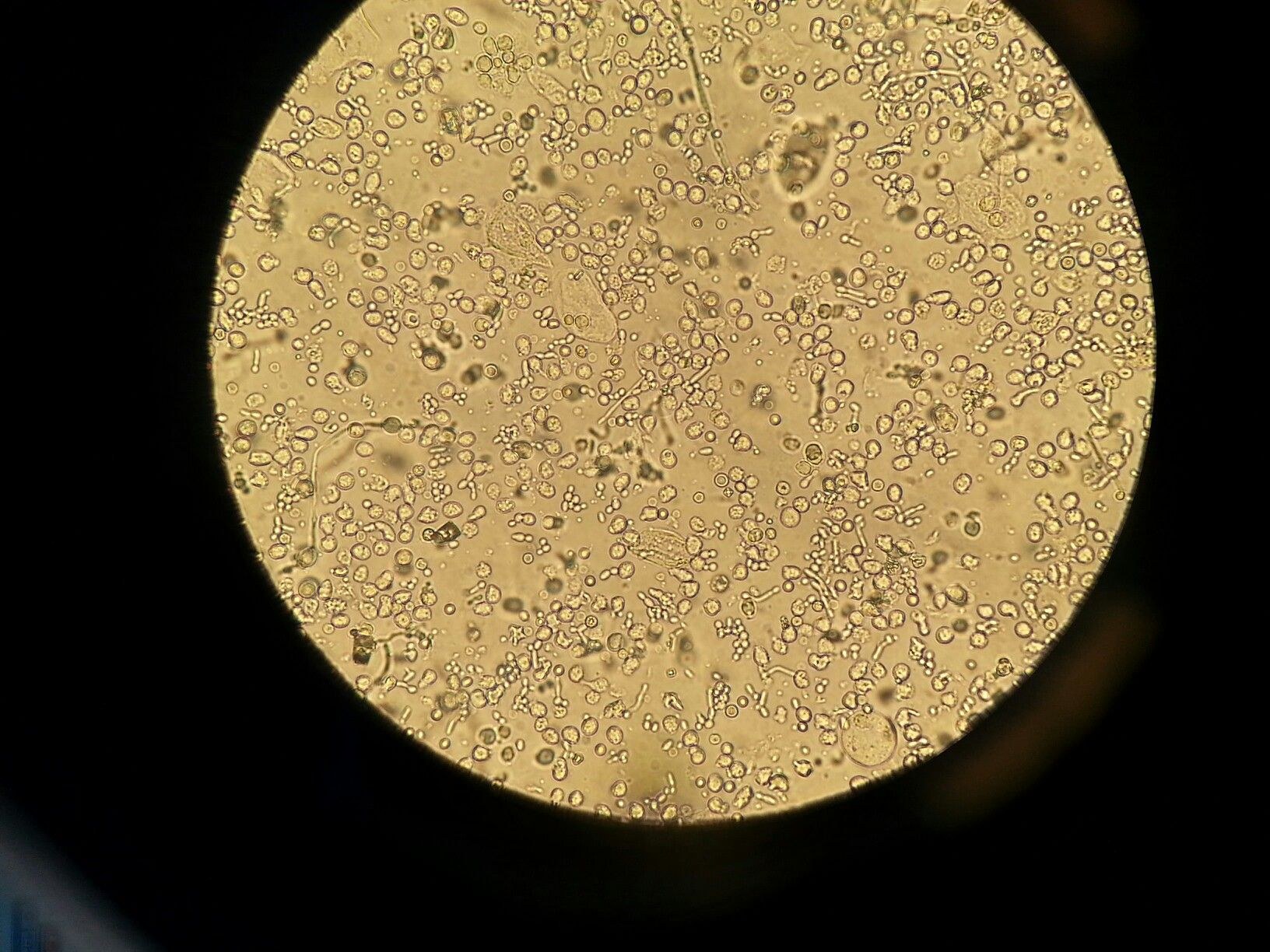Бактерии и белки в моче. Микроскопия кала трипельфосфаты. Цистит микроскопия. Копрология кала микроскопия. Пиурия микроскопия.